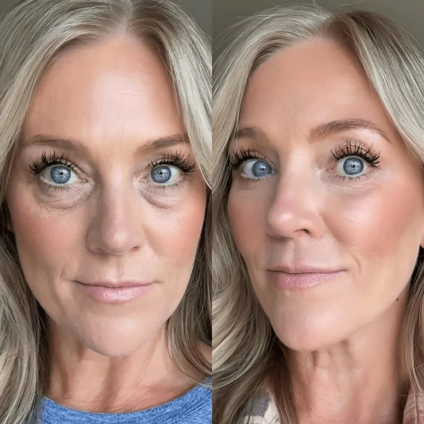 Before and after using RevitalEyes™ red light therapy eye mask for reduced under-eye bags and brighter skin