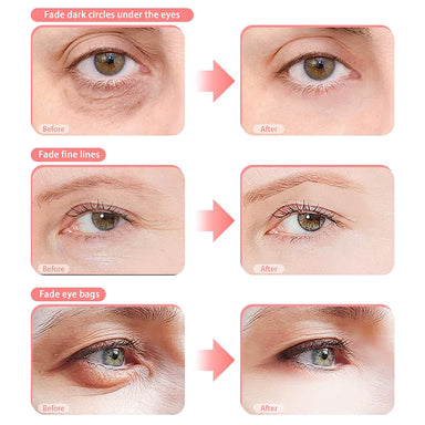 RevitalEyes™ eye mask highlighting red light and EMS microcurrent technology
