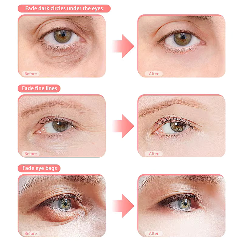 RevitalEyes™ eye mask highlighting red light and EMS microcurrent technology