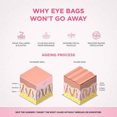 Infographic explaining common causes of under-eye puffiness and dark circles