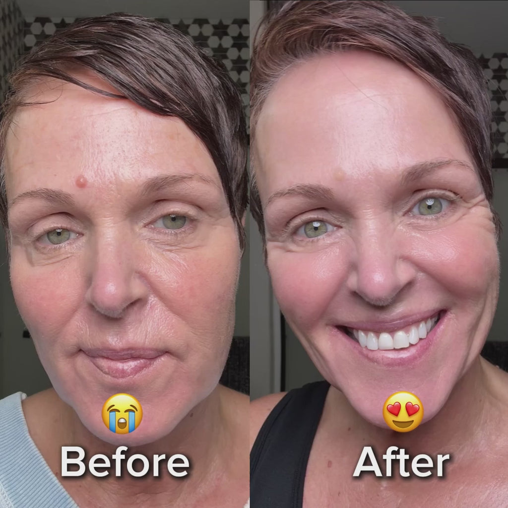 AventoPlus RevitalEyes™ | Red Light Eye Therapy Mask